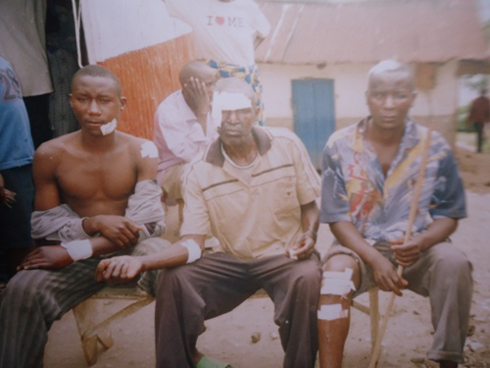 Uva ibumoso: umuhungu wa Harerimana, Ndeze na Harerimana bari ku ivuriro bamaze gutemwa