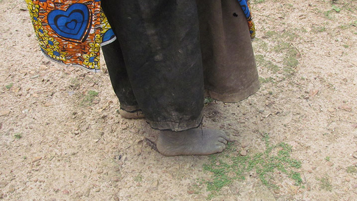 Hari n'abafite amavunja n'ubwo harimo abajyanywe kwa Muganga kugira ngo bahandurwe.