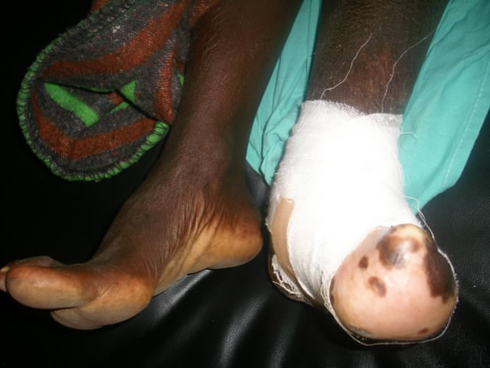 Uko amaguru ya Mukantegeye Josiane yabaye