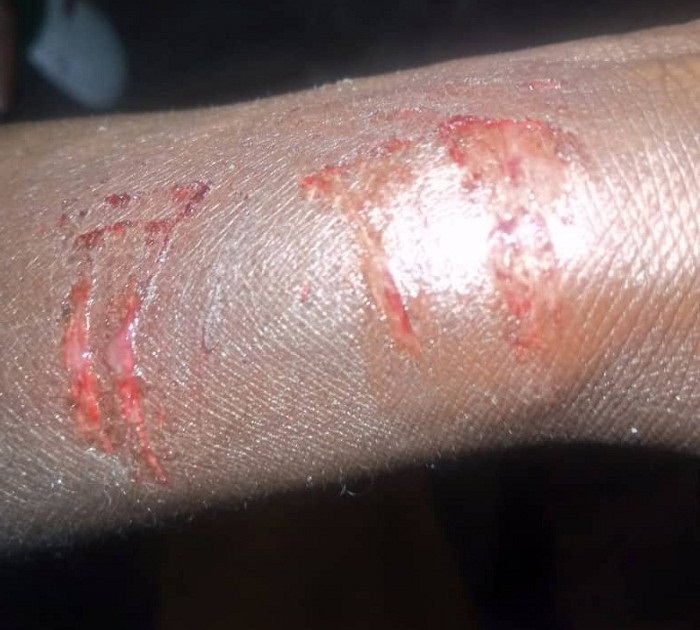 Umukuru w'Umudugudu wa Giramahoro yakomeretse ku kaboka ubwo barimo kuyishakisha