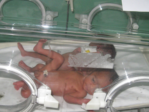 Abana barimo kurererwa mu byuma kubera bavutse badakuze.