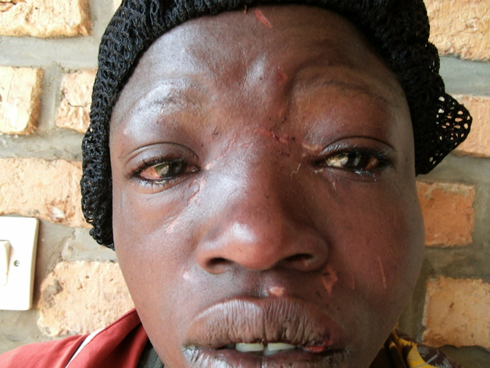 Umurisa Gaudence yahohotewe bigaragara.