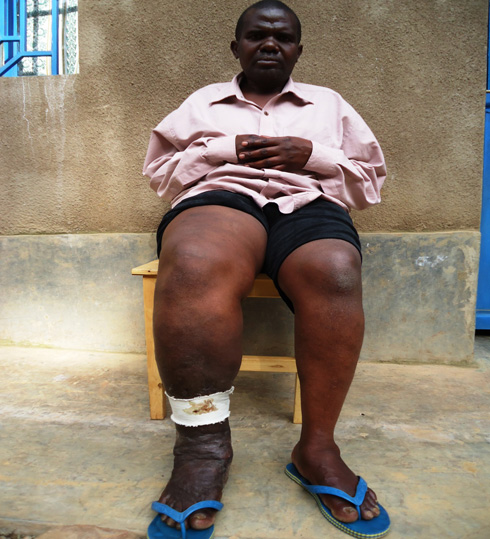 Nzabahungirahe akeka ko uburwayi bw