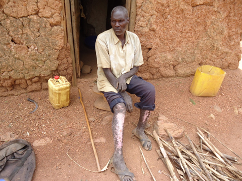 Ikibazo ahura nacyo cyane nuko bimurya akishimagura cyane.