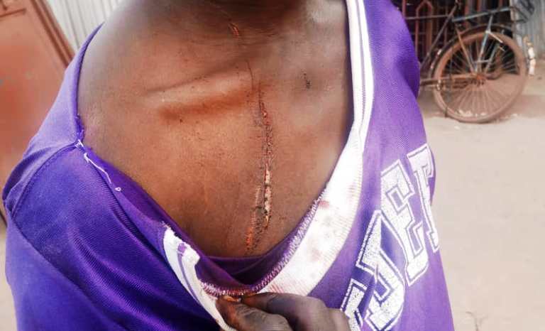 Muri iyo mirwano baremanye inguma