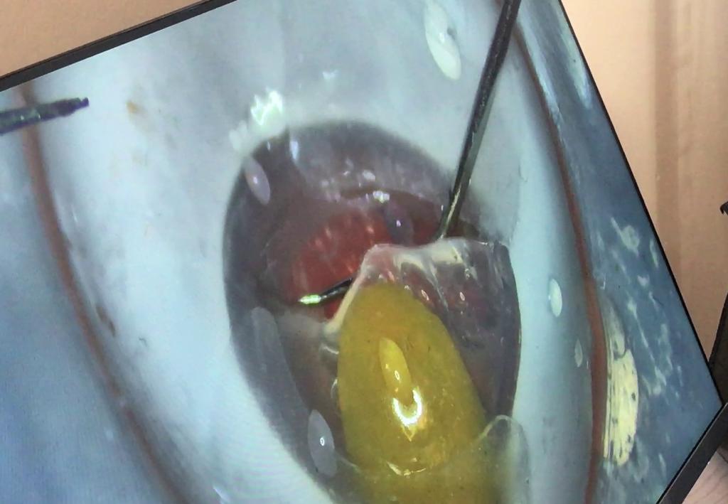 Uko ishaza baribaga mu jisho