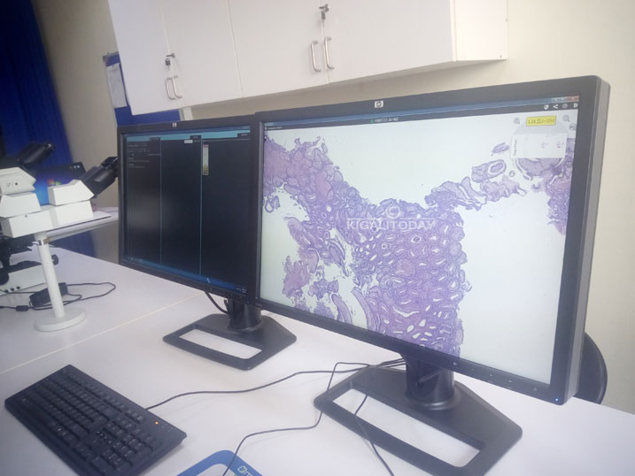 Iyi mashini ifasha abaganga bo hirya no hino ku isi guhanahana ibitekerezo ku ndwara ya kanseri.