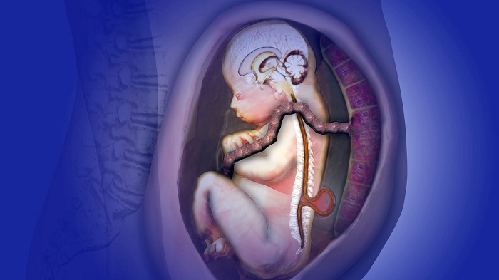 Iyi ndwara iterwa no kwirema nabi k'urutirigongo
