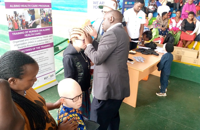 Indorerwamo z'amaso bahawe bavuga ko zizabafasha guhangana n'ibi bihe by'izuba ryinshi