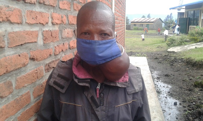 Uwarayeneza Jackson arahangayitse kubera ubu burwayi