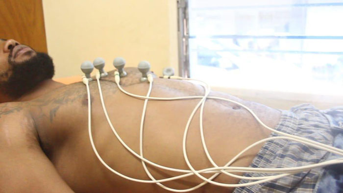 Ngandu Omar akorerwa isuzuma ry