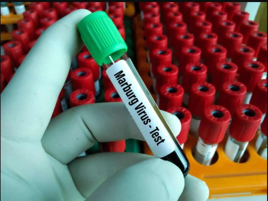 Amerika yakuyeho ingamba zirebana n