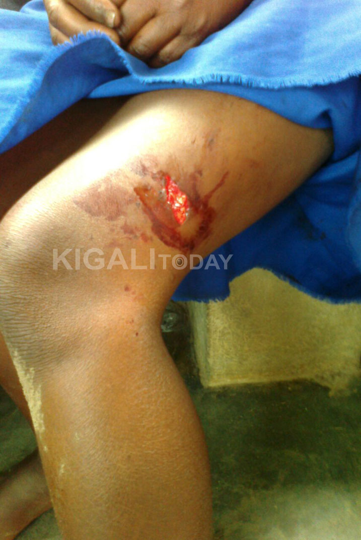 Umwe mu bana bikekwa ko bariwe n'imbwa.