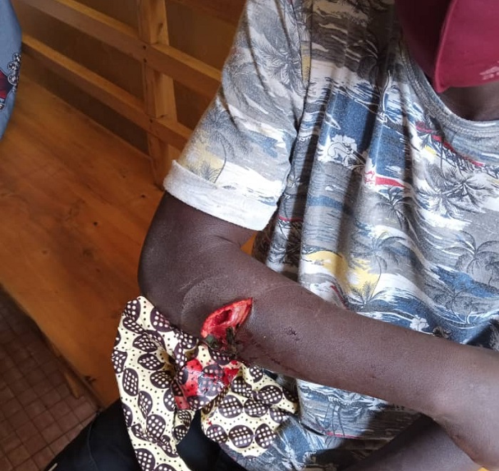 Uyu muturage abo bana biyise Abamarine baramukomerekeje 