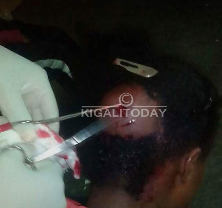 Abakobwa batewe ibyuma mu mutwe ariko abaganga babitayeho byihuse kubitaho ku buryo ubu bameze neza