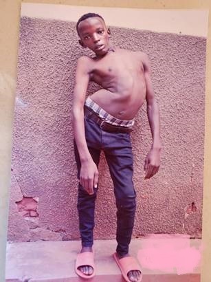 Uko Habanabakize yari ameze mbere yo kuvurirwa mu Buhinde