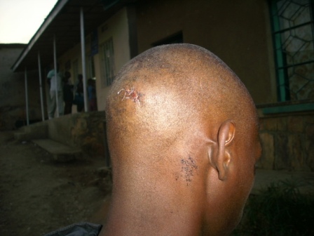 Ntakirutimana Emmanuel wakorewe urugomo birututse ku bunywi bw