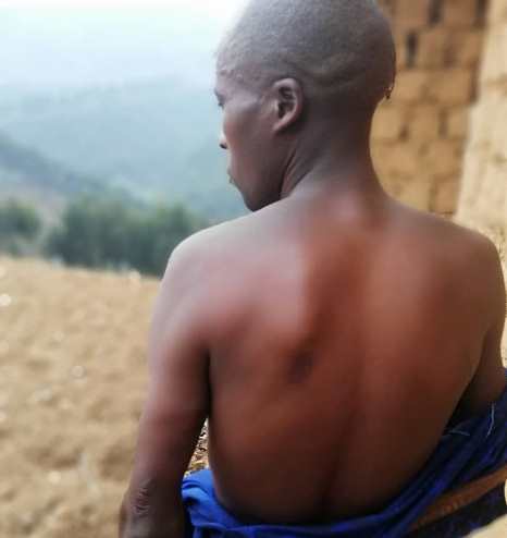 Ntirandekura yarashwe isasu mu bitugu rinyura hafi y'umutima ariko ararokoka