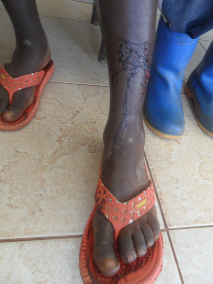 Uyu yamurumye ku kaguru.