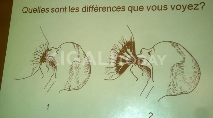 Mu ishusho ya mbere umubyeyi ntabwo yafatishije neza umwana ibere, iya kabiri niyo yereka umubyeyi uburyo bwo konsa neza.