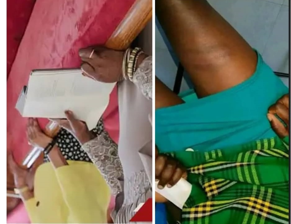 Abo bagore nyuma yo gukubitwa bagiye gutanga ikirego