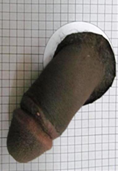 Igitsina cyasiramuwe hakoreshejwe Prepex nta busembwa kigira bushobora guterwa n