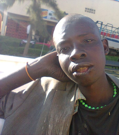 Umunwa wo hasi wavuyeho amenyo yo hasi agaragara hanze