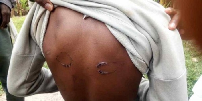 Si byiza gukoresha igihano cyo gukubita umwana