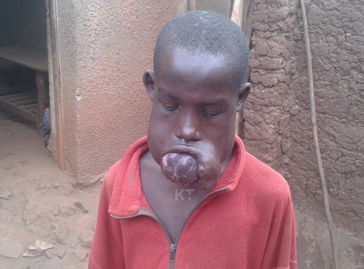 Tuyisenge Emile mbere y'uko agezwa mu bitaro ni uku yari ameze