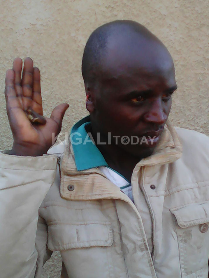 Bapfakurera yagize gukiza uwakubitwaga bamuruma ugutwi baraguca.