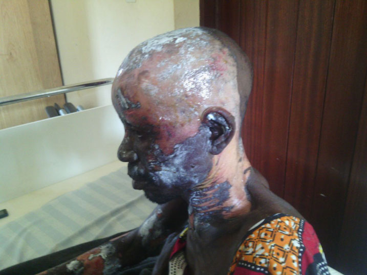 Uyu mugabo ngo yatwitswe n'umuhungu we yibyariye.