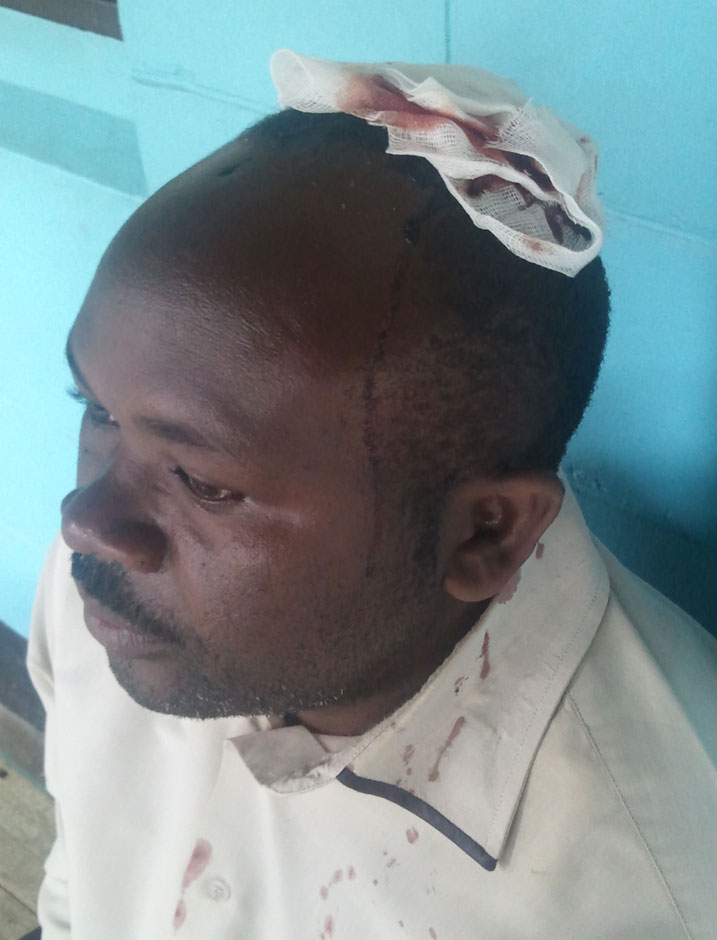 Umwe mu bari mu modoka bagakomereka.