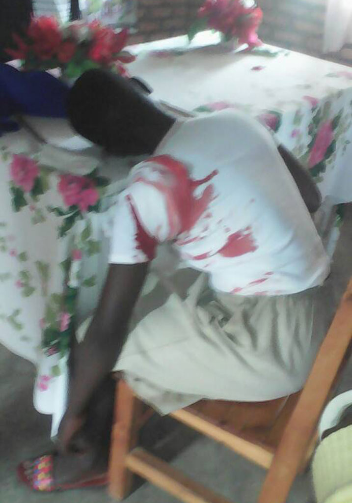 Mukeshimana watewe icyuma ku rushyi rw