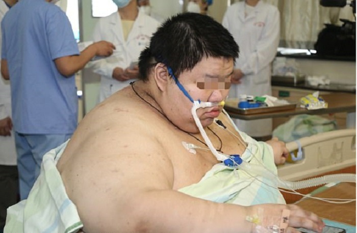 Yiyongereye ibiro birenga 100 mu mezi atanu gusa