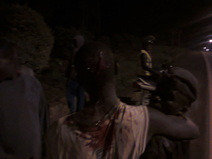 Aphrodis yakomerekejwe mu mutwe n