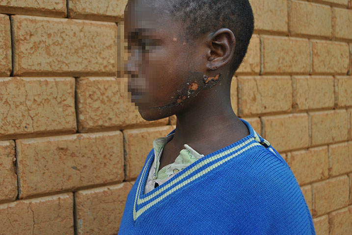 Uyu mwana yatwitswe na Se akoresheje icyuma gishyushye.