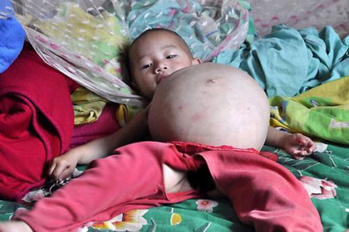 Mengru Kang abyimba inda buri munsi. 