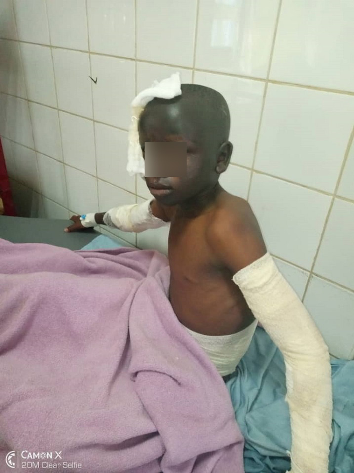 Umwana wa Nagapfura na we yakomerekejwe bikomeye na gaz