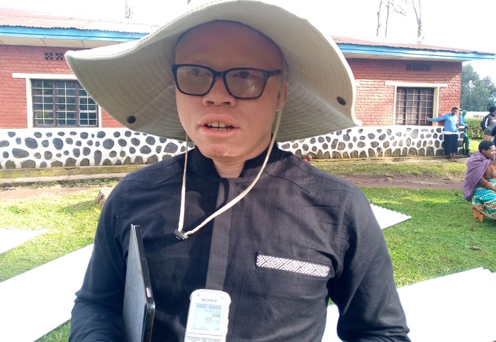 Uwimana Fikili Jayden, Umuyobozi w'Ihuriro Nyarwanda ry'Abafite ubumuga bw'uruhu (Rwanda Albinism Network-RAN)