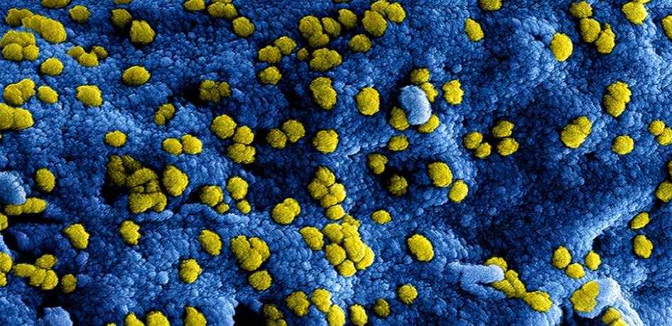 Abanduye iyi virus mu Bushinwa bakomeje kwiyongera/ Ifoto yavanywe kuri interineti