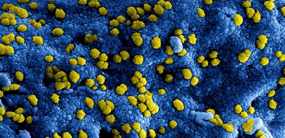 Iyo virusi yandurira mu mwuka