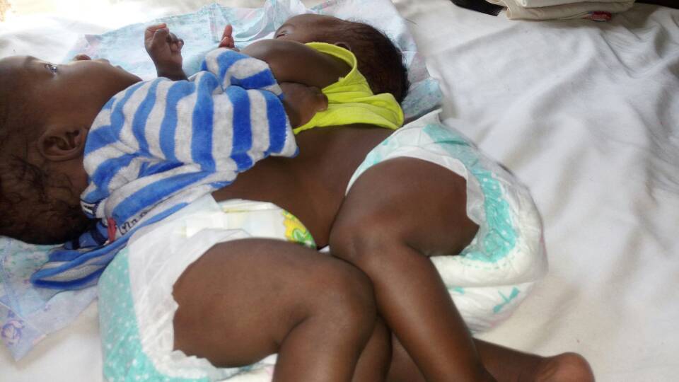 Ni uku aba bana bameze nyuma y'amezi atatu bavutse bafatanye