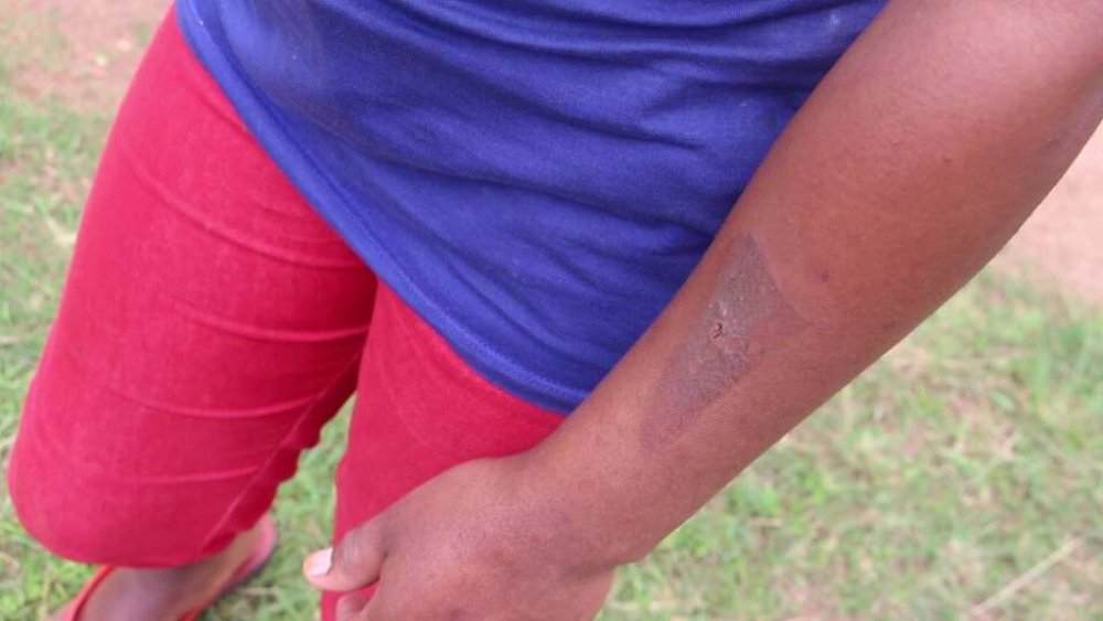 Ku mubiri we hagenda hagaragara inkovu z'ipasi