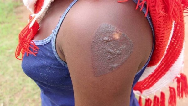 Aho yagiye atwikishwa ipasi na nyirabuja na bagenzi be bari bafatanyije