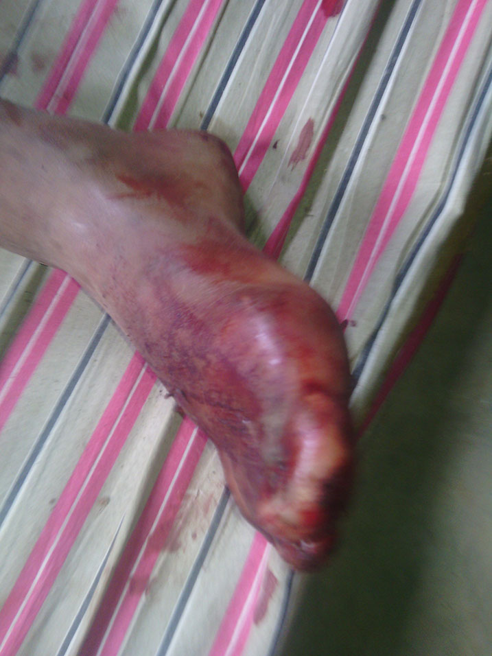 Yakomerekejwe ahantu hatandukanye bigaragara ko yakubiswe n