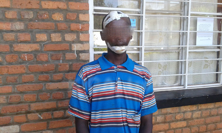 Yatemwe na murumuna we anamuruma umunwa wo hasi arawuca.