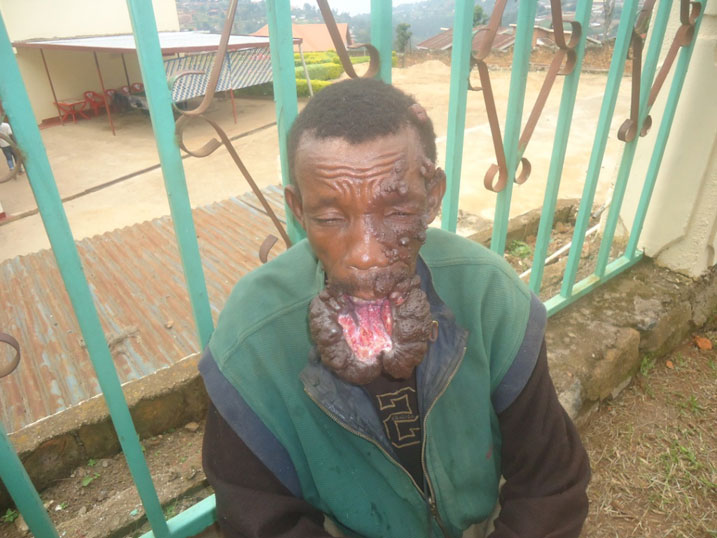 Yozefu arifuza ubufasha bw'ubuvuzi.